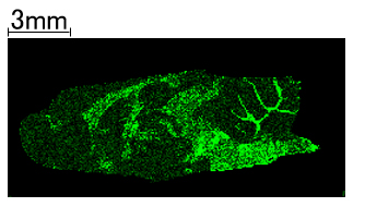 コレステロール(CH)
