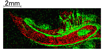 Ca(赤)、リン脂質(緑)